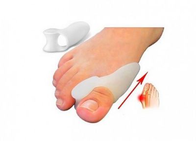Фиксатор большого пальца Valgus Pro (Вальгус Про) в Новосибирске